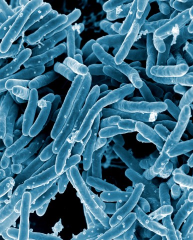 mycobacterium Image
